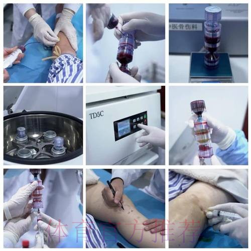 居勒尔将接受富血小板血浆注射 若没效果就将手术